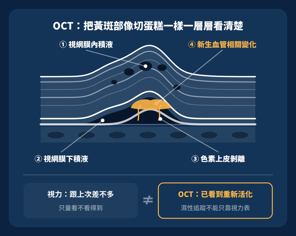 老年性黃斑部病變:看東西變形,千萬不要只以為是老花 oct為什麼重要