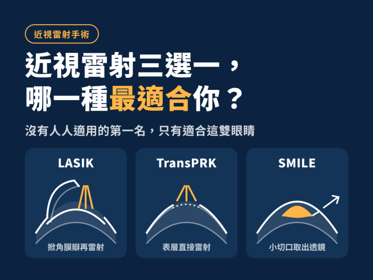 TransPRK、LASIK、SMILE：為什麼沒有人人都適合的第一名？