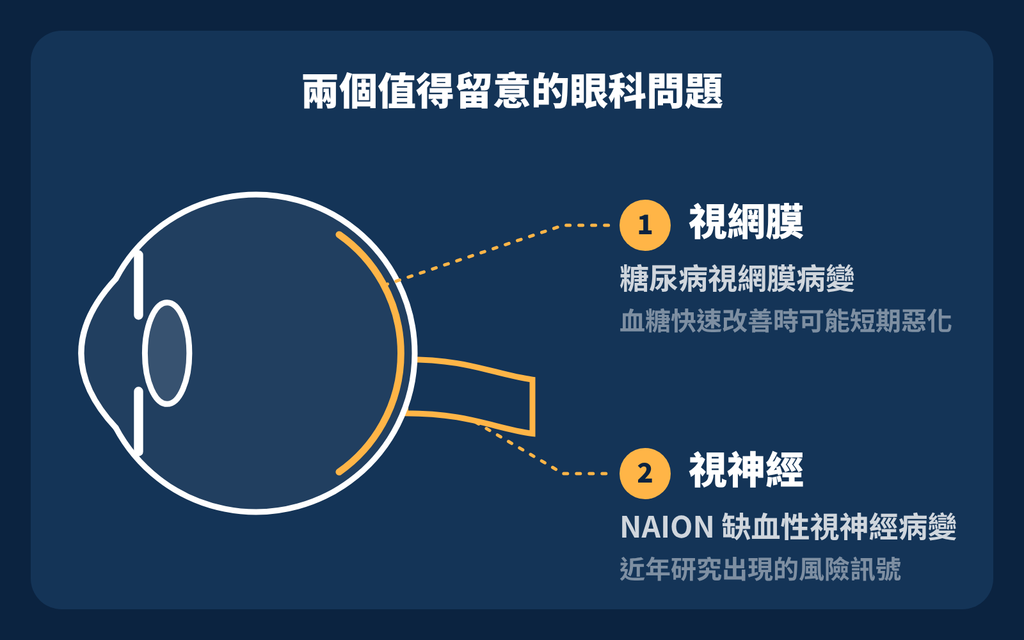 打瘦瘦針會影響視力嗎?眼科醫師提醒:有兩件事值得注意 兩個值得注意
