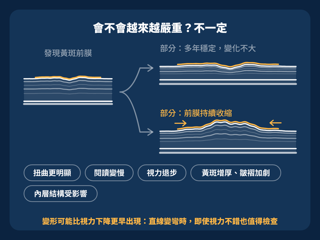 黃斑前膜視力還不錯,為什麼看東西變形也值得評估? 會不會更嚴重