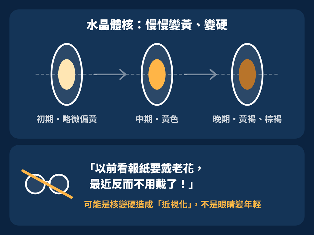 白內障不只一種!認識白內障的三大分類 核性白內障
