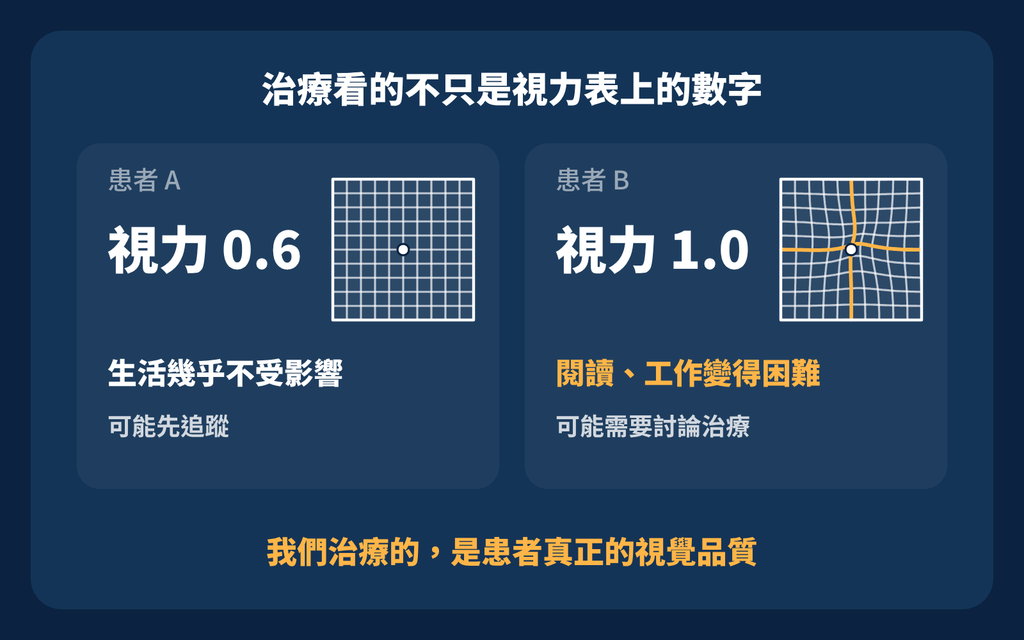 黃斑前膜視力還不錯,為什麼看東西變形也值得評估? 治療不只是視力表上的數字