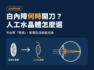 白內障何時開刀 精選縮圖