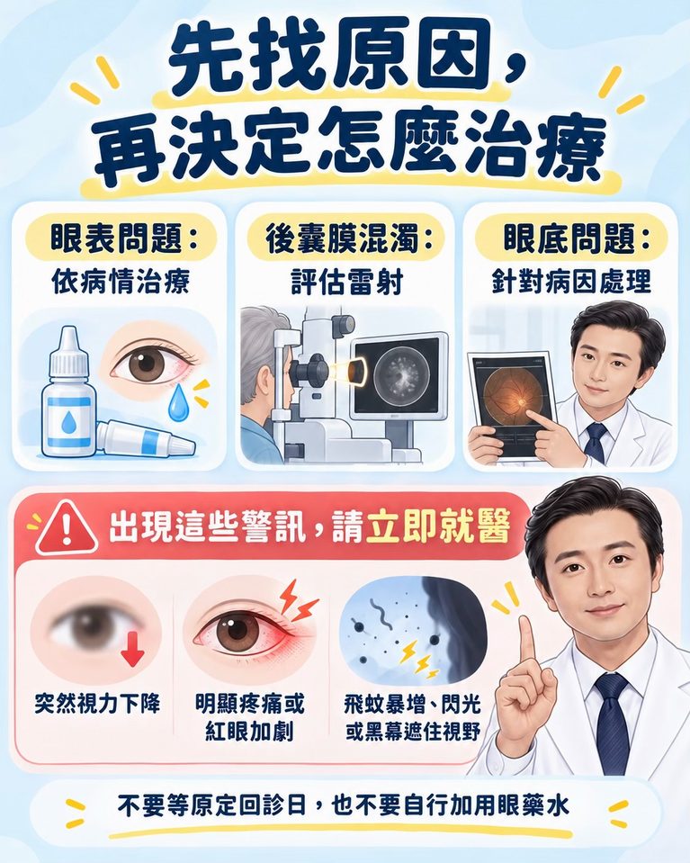 白內障手術後又變霧，是白內障復發了嗎？