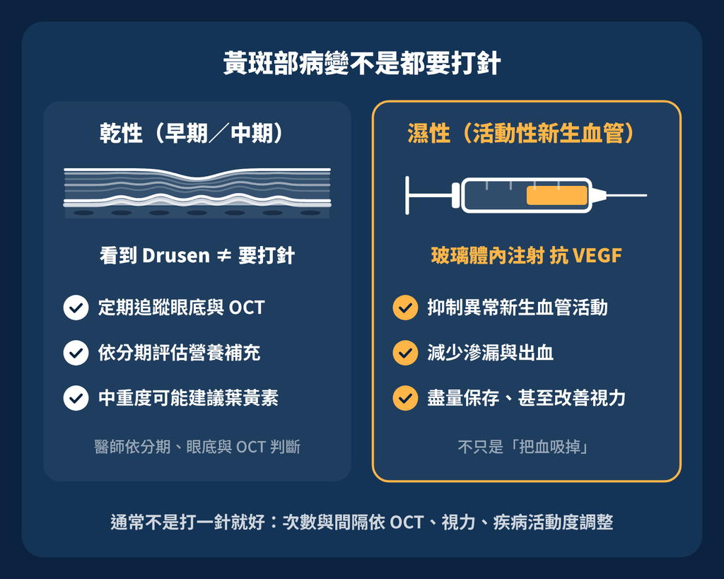 老年性黃斑部病變:看東西變形,千萬不要只以為是老花 黃斑部病變是不是都要打針