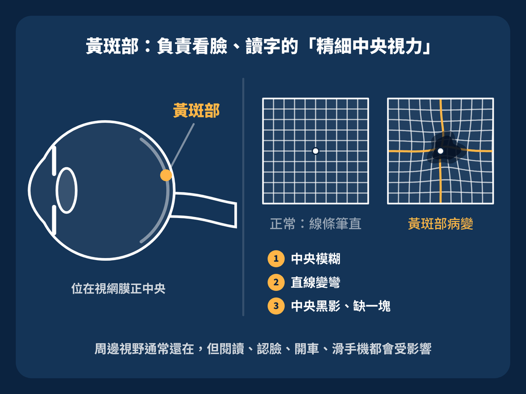 黃斑部，中央視力